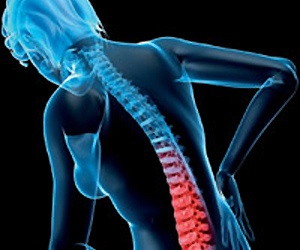 Loãng xương: Căn bệnh nguy hiểm